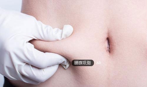 腰腹吸脂