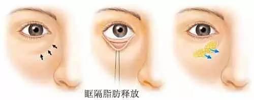 脂肪