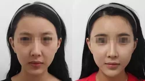 填充后效果