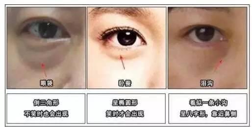 脂肪