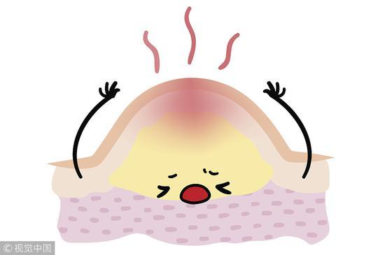 痘痘