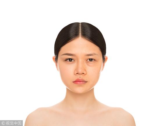 眼袋
