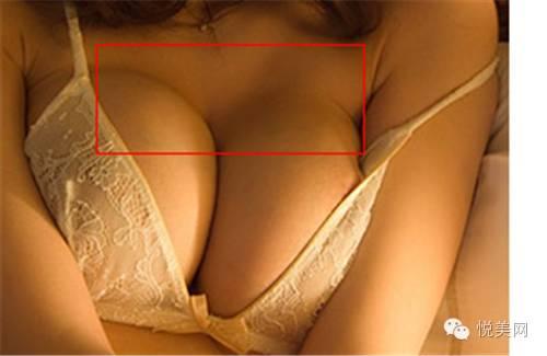 上推乳房时