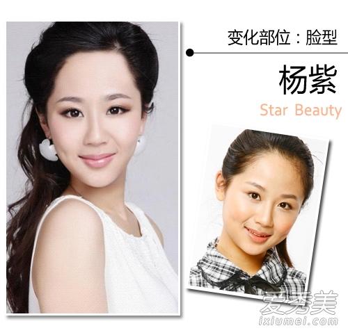 变化部位:脸型