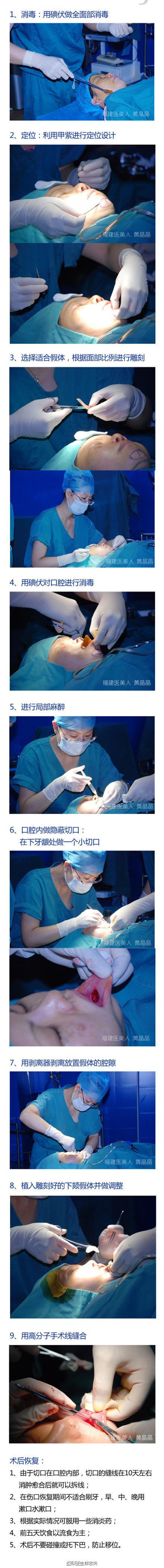 图解