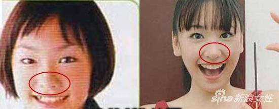 新垣结衣 鼻子对比图