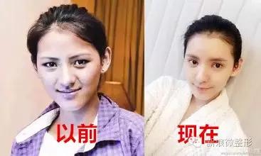 逆袭的张予曦
