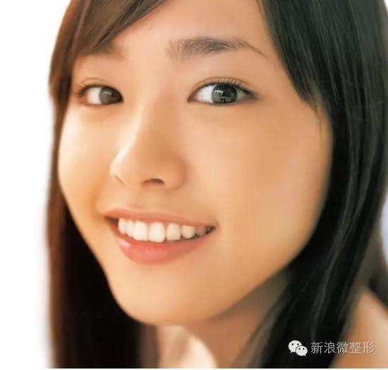 新垣结衣