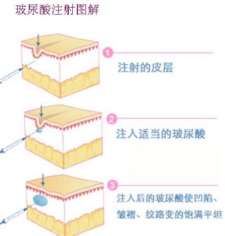 资料图