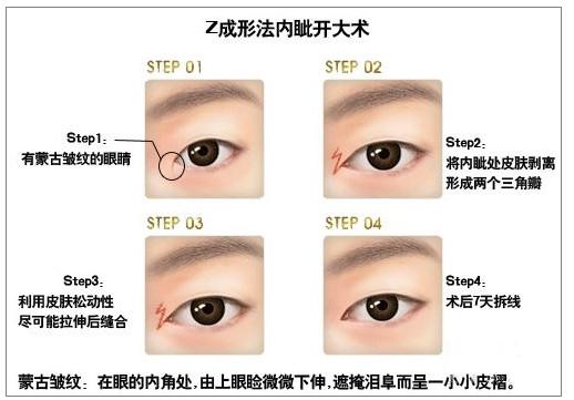 Z成形法