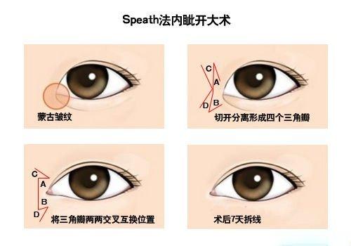 Speath法