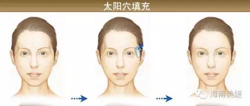 资料图
