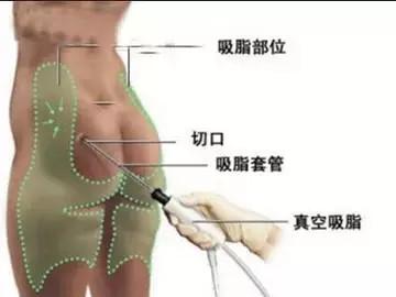 资料图