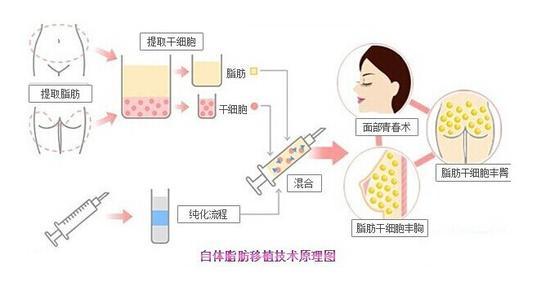 资料图
