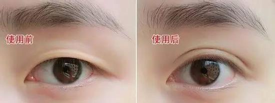 使用前后