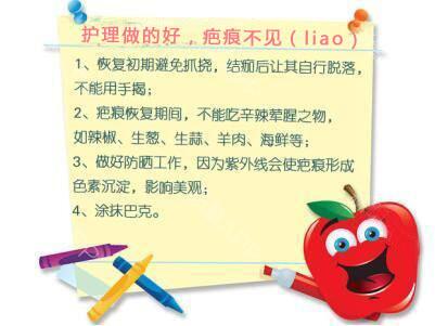 护理做的好