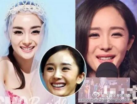 杨幂