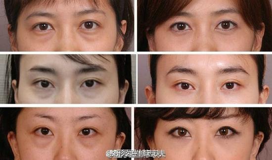 眼袋