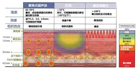 参数