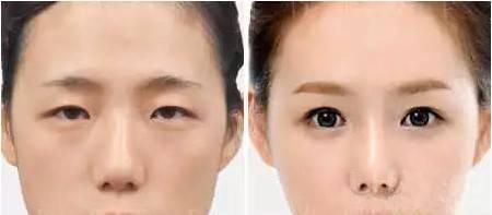 眼部
