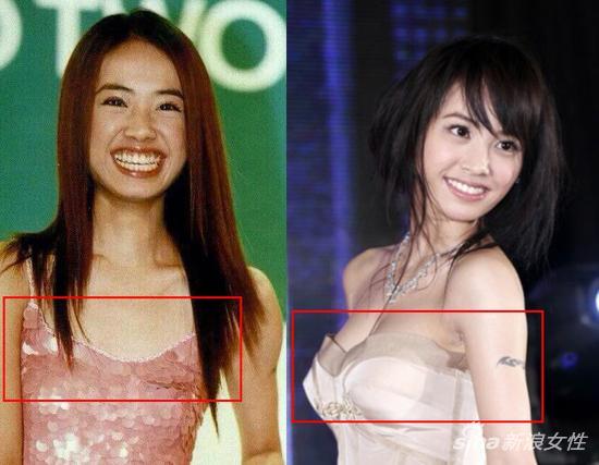 胸部对比