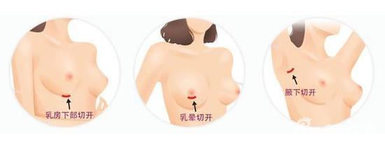 切口示意图
