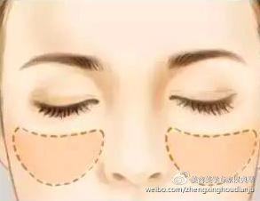 饱满的苹果肌