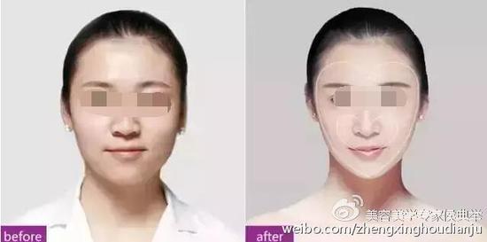 心形脸