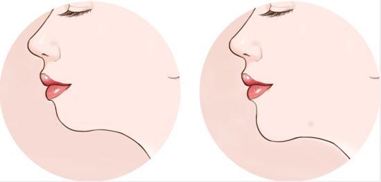 效果