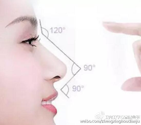 玻尿酸隆鼻