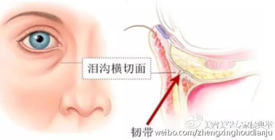 先天性