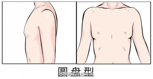 圆盘型