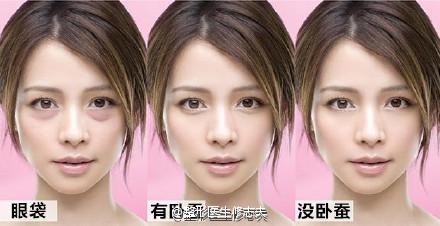 眼袋和卧蚕