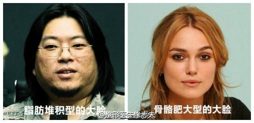 脂肪型和骨骼型