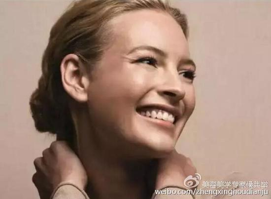 细小皱纹出现