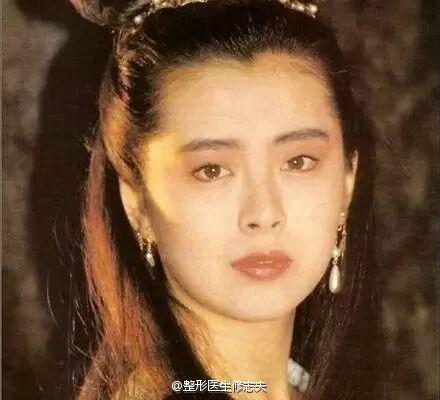 美人尖