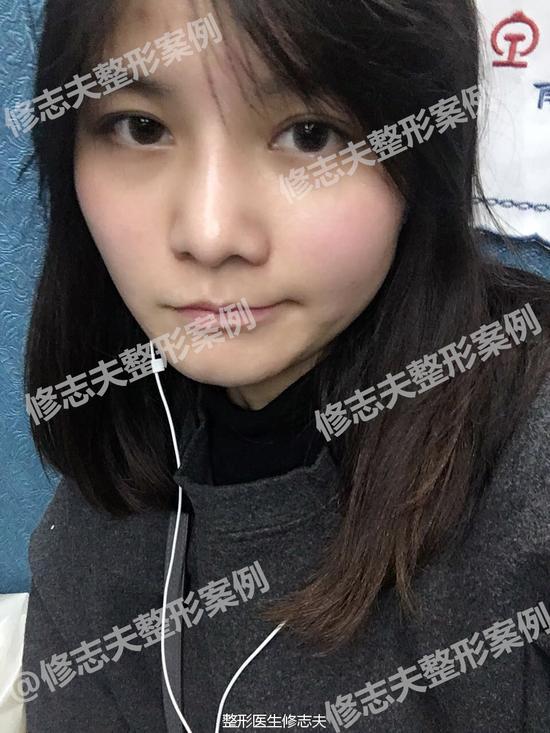 术后三个月