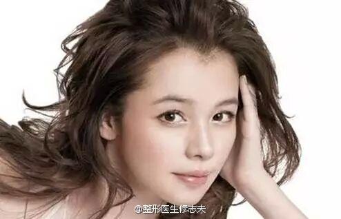 美人尖