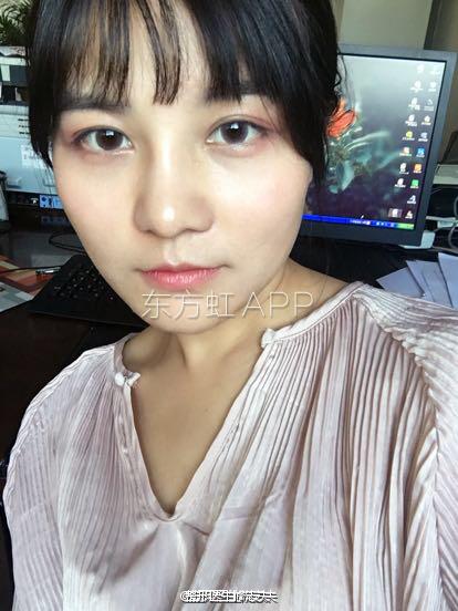 术后