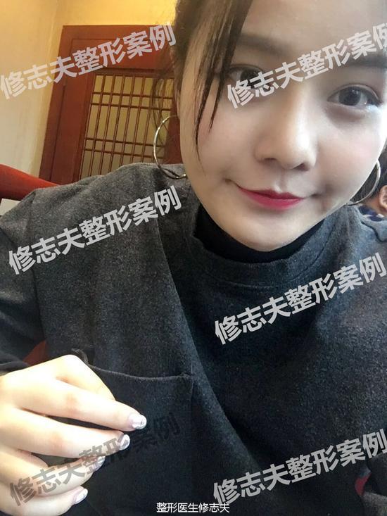 术后三个月