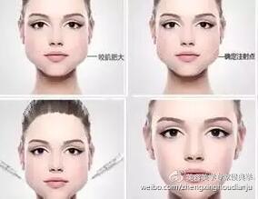 瘦脸