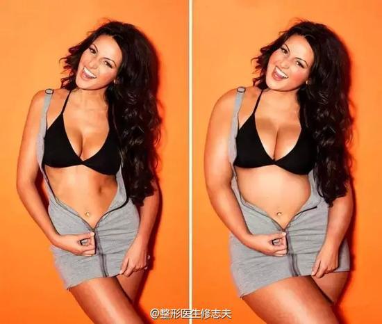 Michelle Keegan