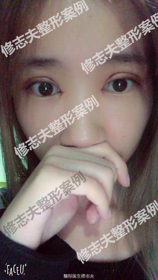 术后第三天