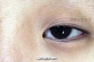 导致皮肤松弛
