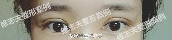 对比