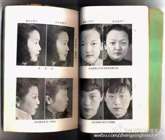 案例照片