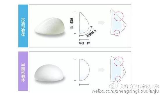假体丰胸