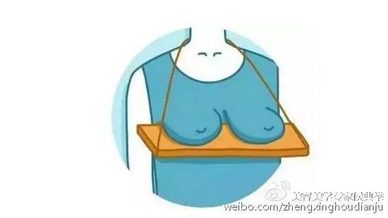 假体丰胸