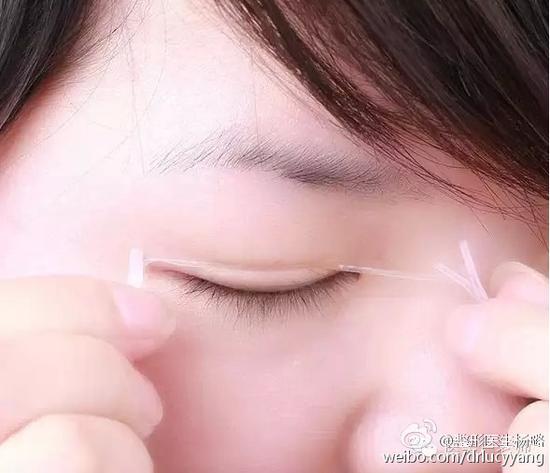贴双眼皮贴