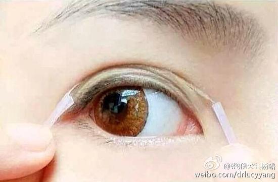 贴双眼皮贴